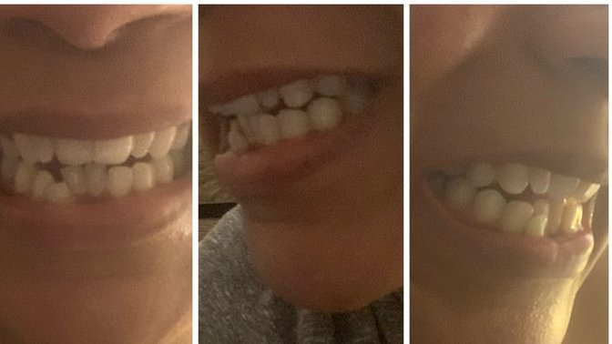 Guys, Would you date a woman with teeth like this?
