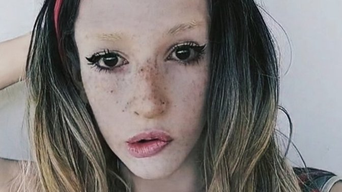Do you think freckles are cute?