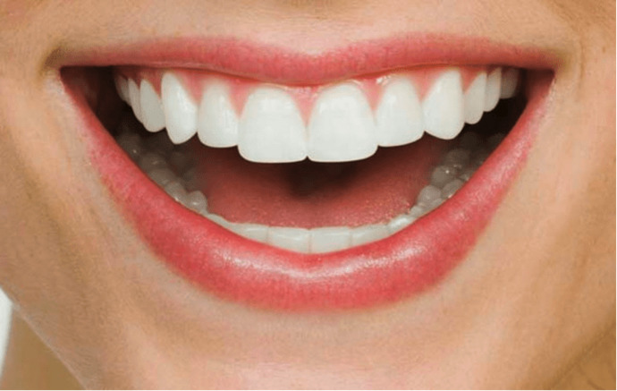 Have you ever worn braces, and if so how long did you have them for?