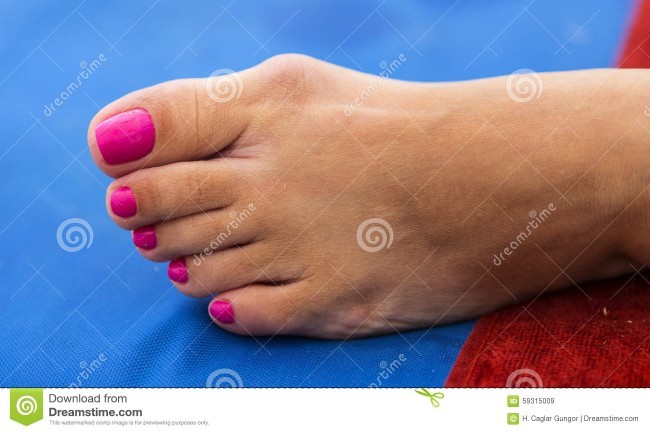 Men, would you date a woman who has feet like this?