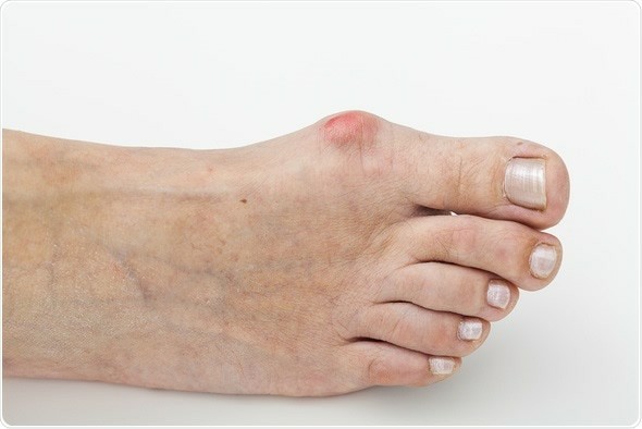 Men, would you date a woman who has feet like this?