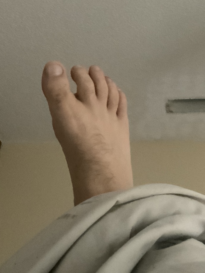 Men, would you date a woman who has feet like this?