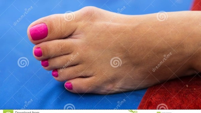 Men, would you date a woman who has feet like this?