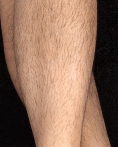 Is it an average female hairy leg?