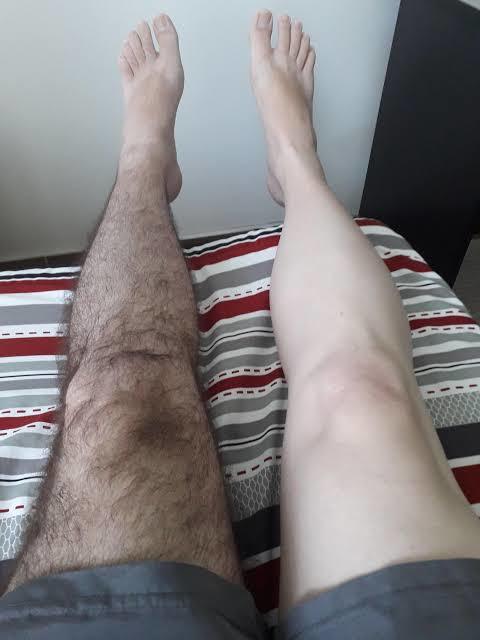 Natural more than average hairy legs or hair removed on men?