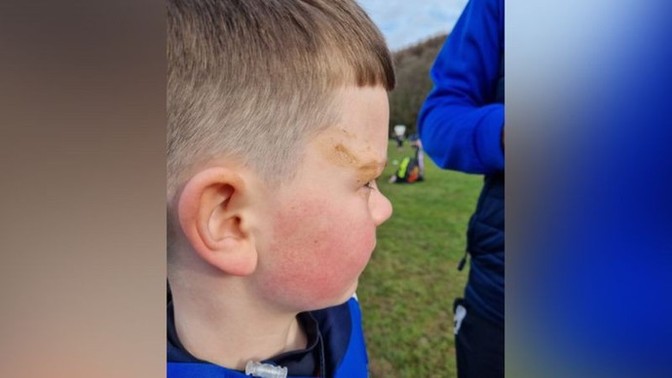 If your kid rolled in dog poo would you take a picture?