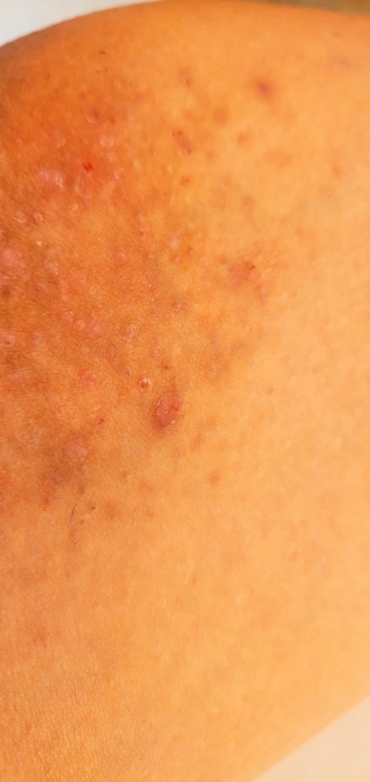 Bikini line help? GirlsAskGuys