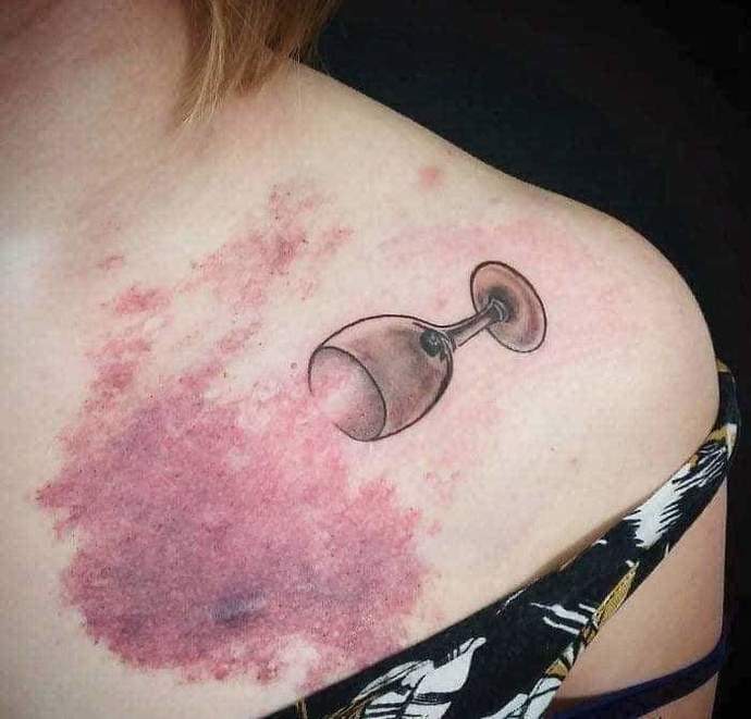 Do you irritate from your body scars, dont worry make them beautiful ❤️?