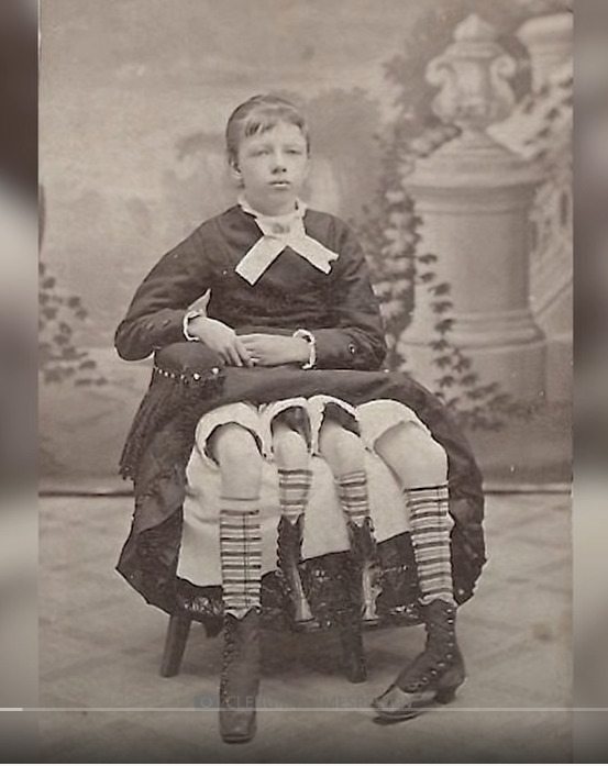 With the 4 legged woman. If she has 4 legs she probably has 4 tits too so no one will even be looking at you