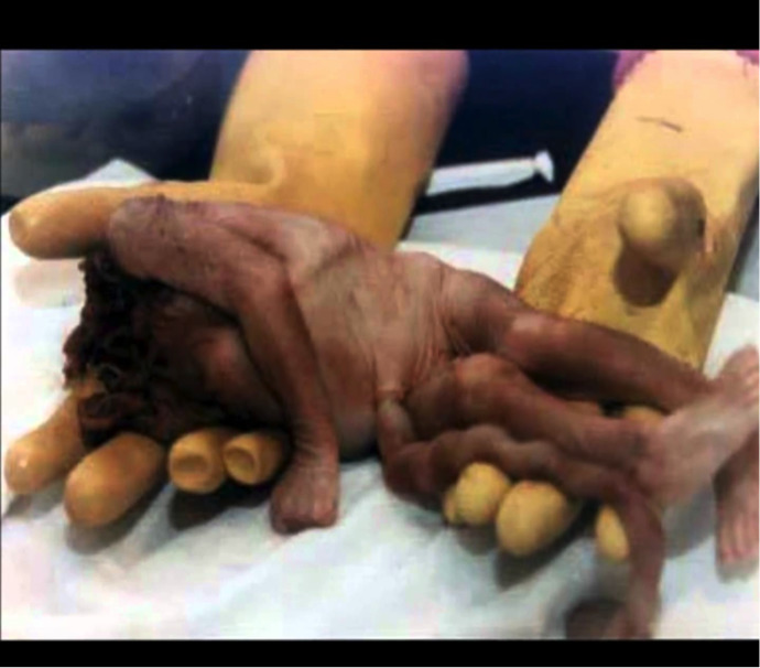 Sounds like Roe v Wade is overturned. Thoughts?