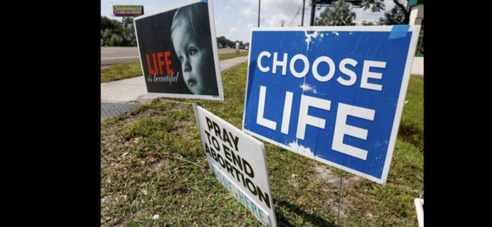 If you are, why are you pro-life?