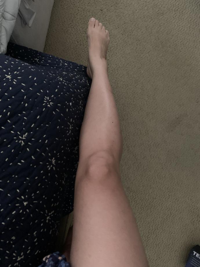 How do I improve my foot arch?