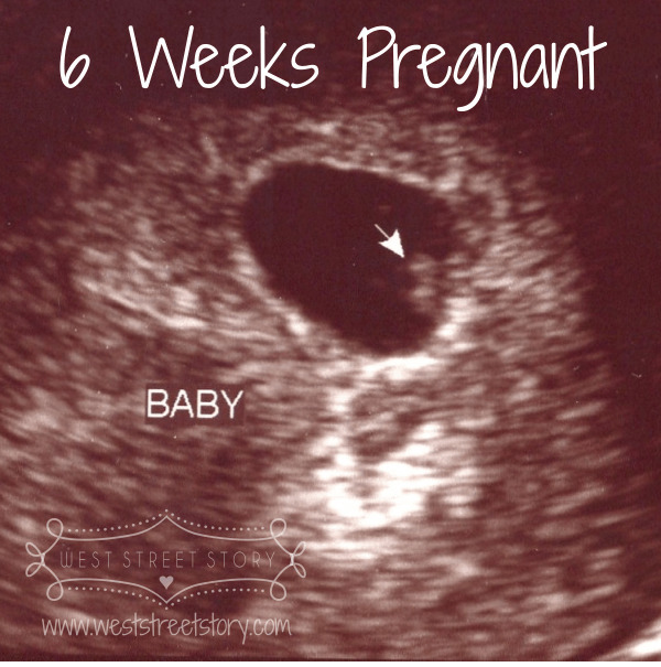 If you are Pro-Life when it comes to abortion, what would you say to an actual pregnant woman who wants to abort, to convince her not to?