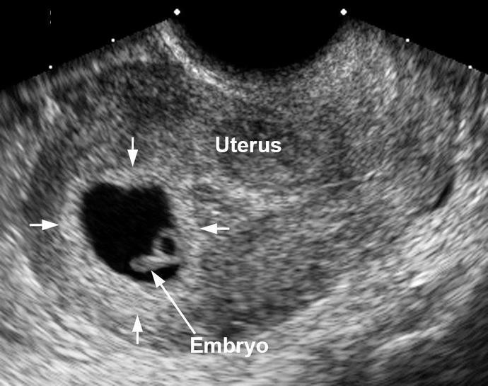 If you are Pro-Life when it comes to abortion, what would you say to an actual pregnant woman who wants to abort, to convince her not to?