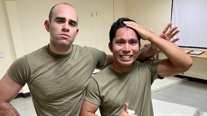 Fight aftermath: How bad or cool is this scar?