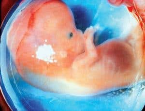 When does the fetus become a soul?