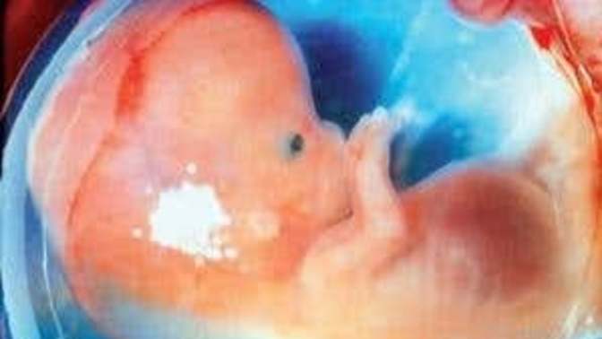 When does the fetus become a soul?