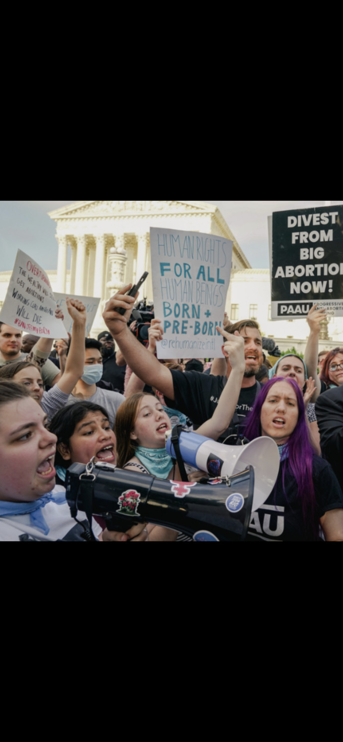With the real possibility of the overturning of Roe V. Wade, do you think states should be allowed to make whatever laws they want around abortion?