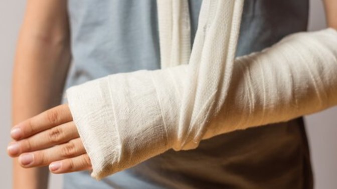 Have you even broken a bone before?