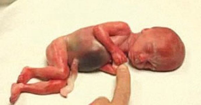 Abortion. Nothing in the Bible, or any religious text (prove me wrong), that says abortion. So what right do others have to say a woman can't?