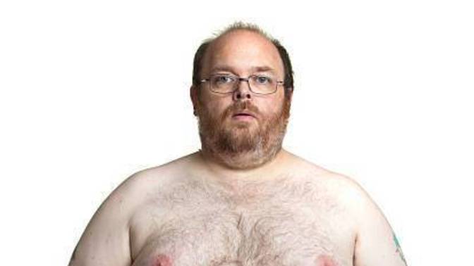 Girls, which would be the worst physical thing to have on a guy whose personality you strongly liked and wanted to date?