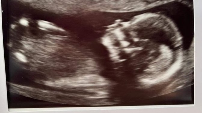 Am I having a boy or a girl?