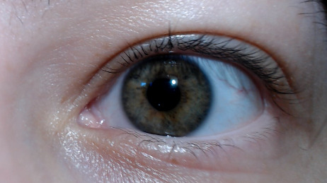 Right eye