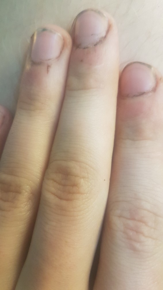 Why are so many guys so damn dirty minded?
