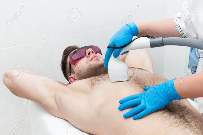 Do you think laser hair removal is a good option for a very hairy male?