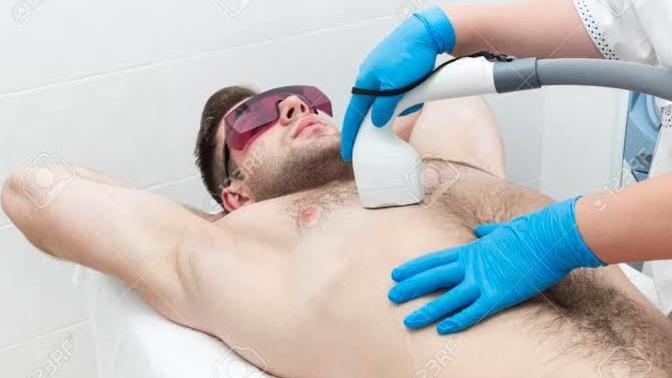 Do you think laser hair removal is a good option for a very hairy male?
