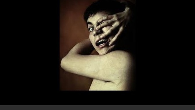 Does anybody on here have the Alien Hand Syndrome?