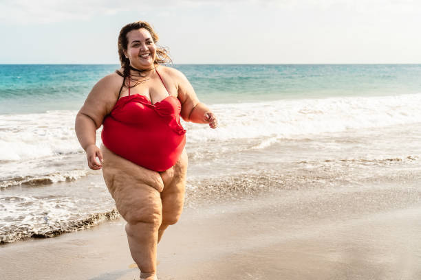Should obese women be allowed to go the beach?