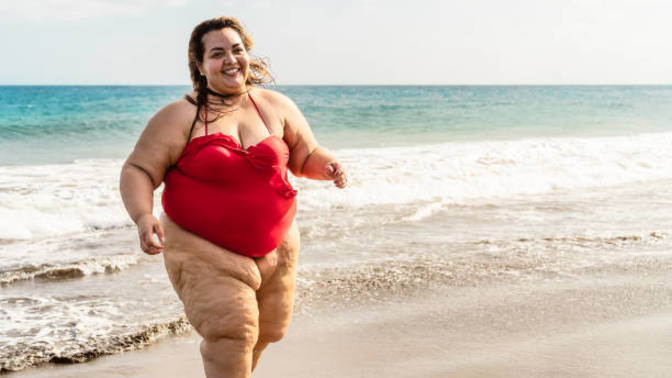 Should obese women be allowed to go the beach?