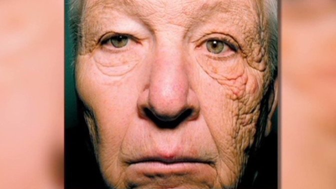 Do you wear sunscreen often?
