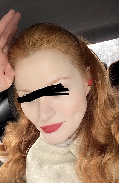 IM so confused…are these girls real gingers?