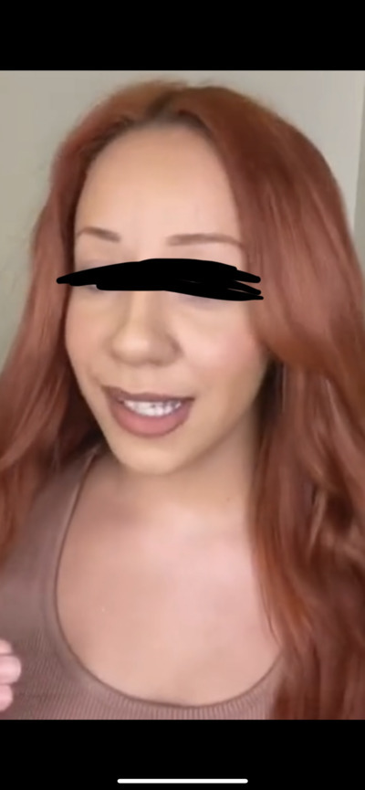 IM so confused…are these girls real gingers?