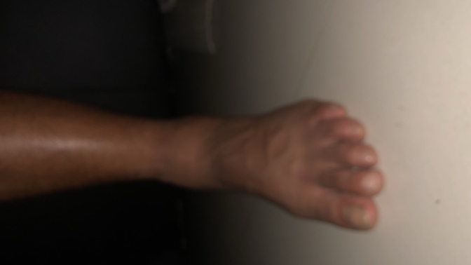 Is this fixable it hurts?