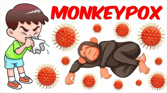 Will you get the monkey pox vaccine?