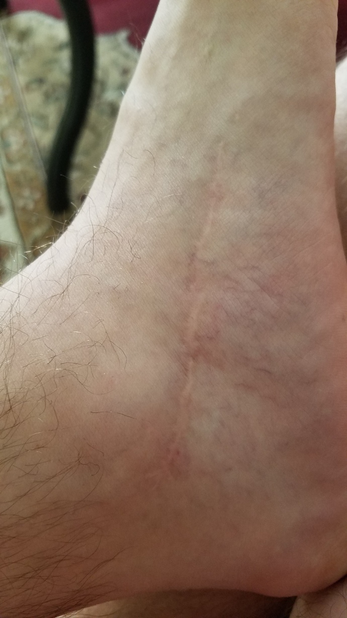 How did you get your scar or scars?