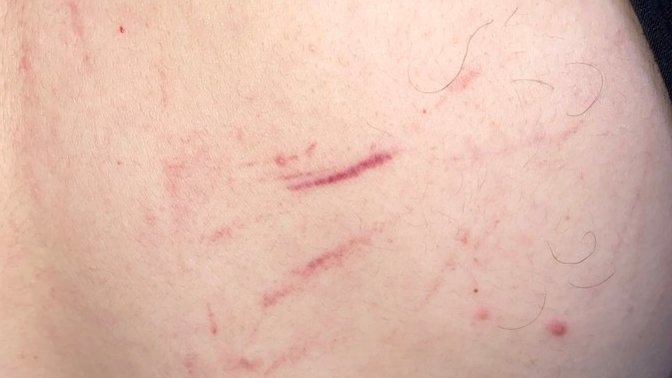 Do these scratch marks look like they are from a females fingernails? Please help? My gut feeling is telling me he’s cheating?