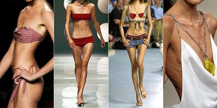 Why do people call models anorexic?