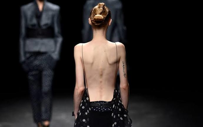 Why do people call models anorexic?