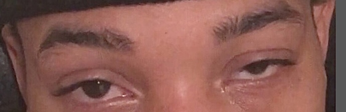 Do you think I can change this without surgery?