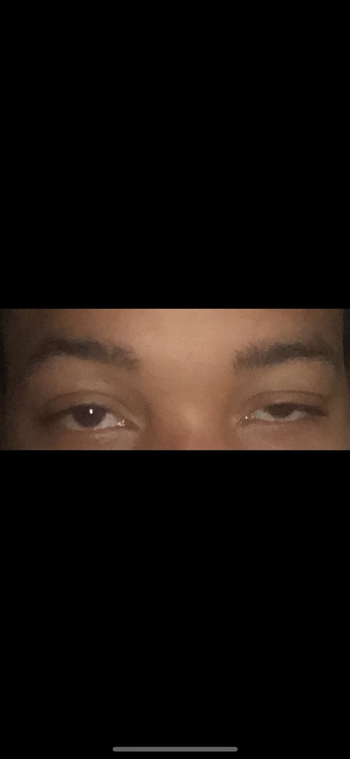 Do you think I can change this without surgery?