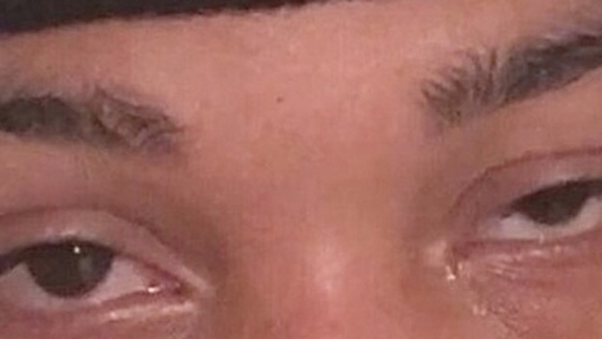Do you think I can change this without surgery?