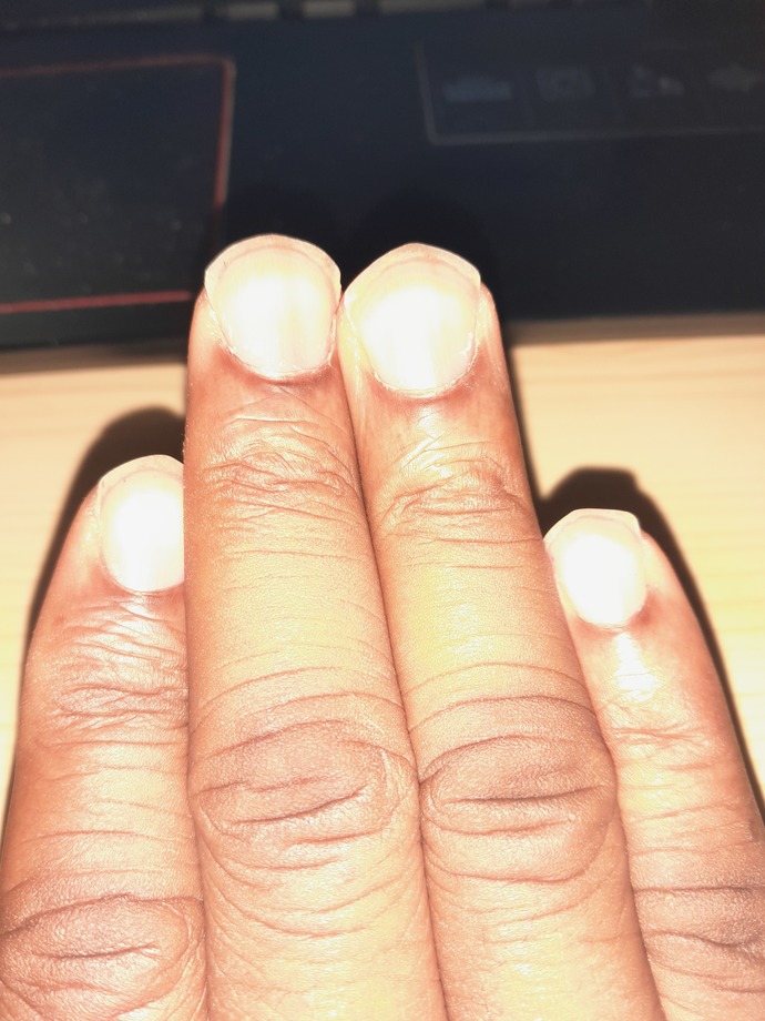 Right hand