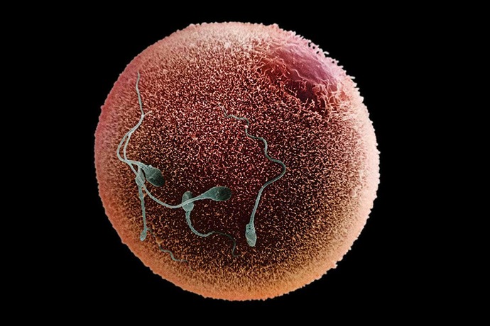 Would you ever eat a human egg?