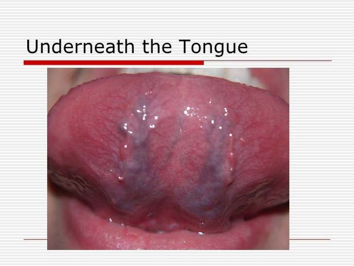 Anyone have two coloured tongue 😛?