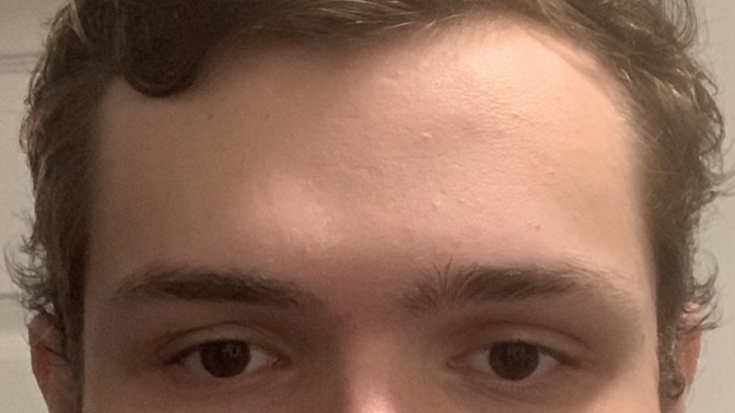What type of face shape do I have/what would be an optimal haircut for me?