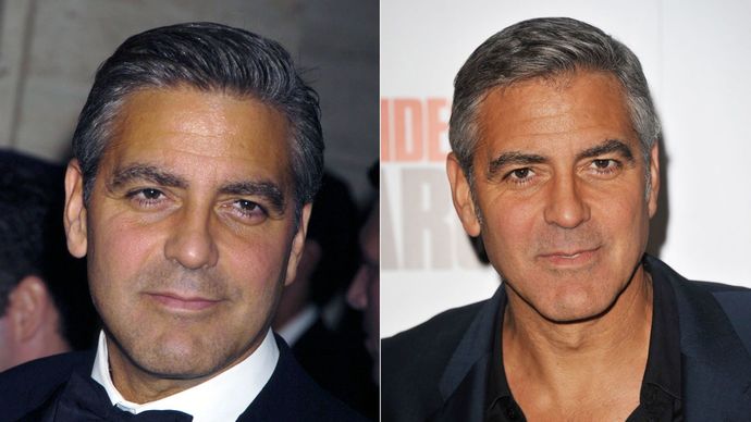 What are the chances of a man reclaiming his youth?
